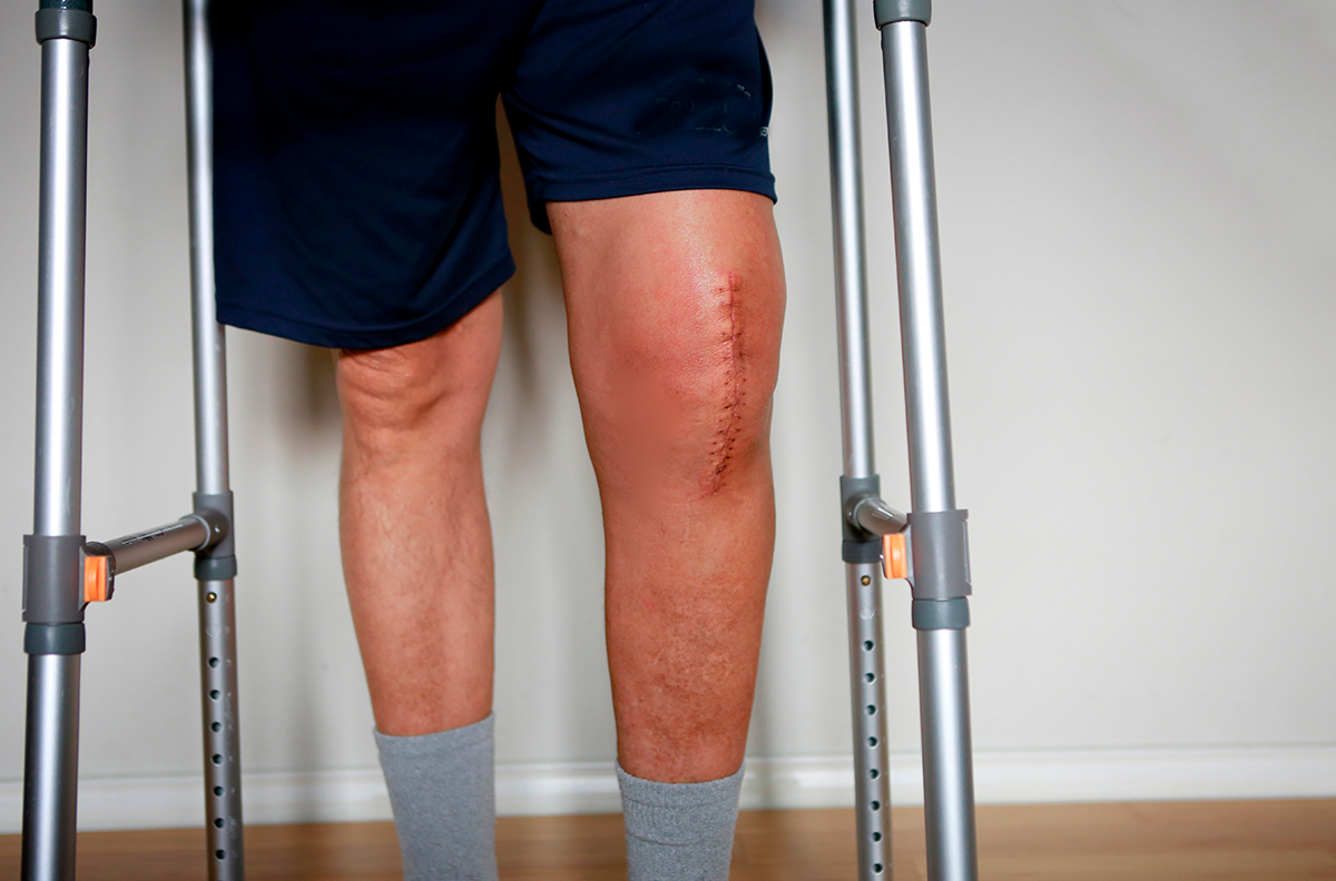 fisioterapia-postoperatorio