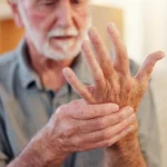 Tratamiento para parkinson