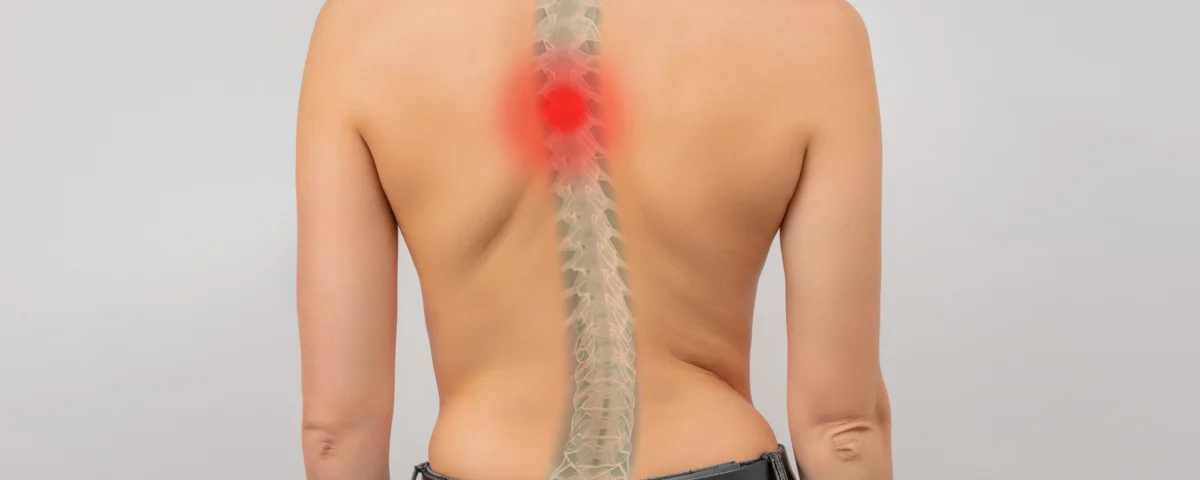 Escoliosis en San Martin Texmelucan